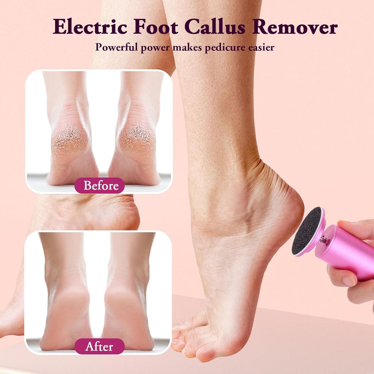 Elegmore™ Electric Foot Callus Remover